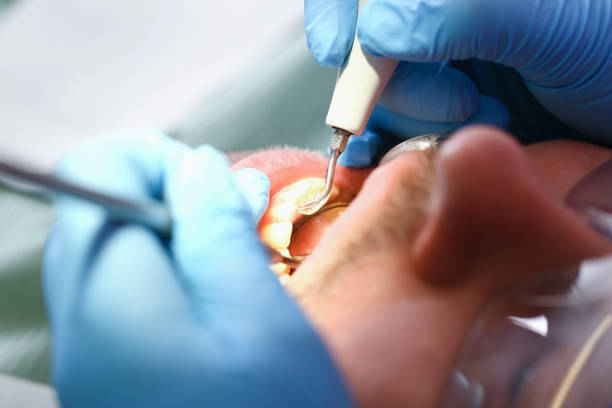 Best Emergency Dental Care for Sports Injuries in Riverdale, GA