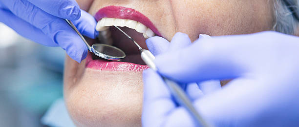 Best Knocked-Out Tooth (Avulsed Tooth) Treatment in Riverdale, GA
